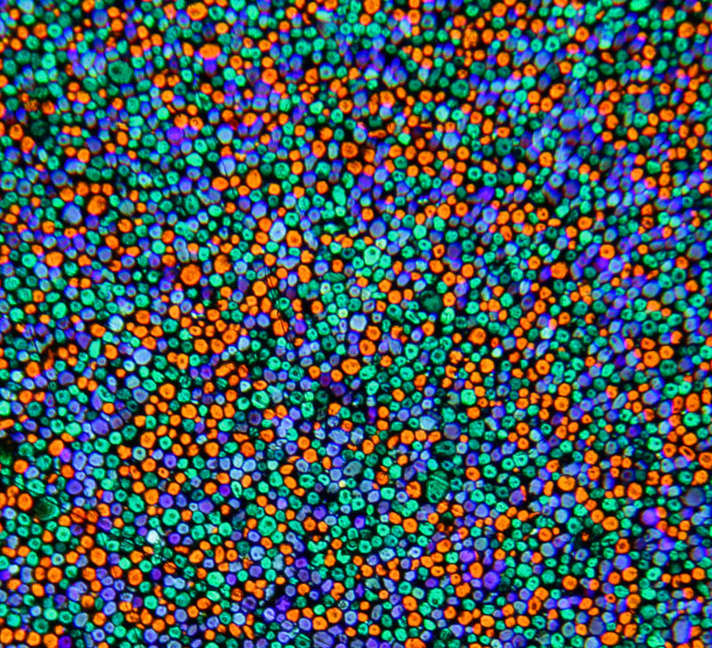 Микрофото растра Автохрома: зёрна крахмала RGB